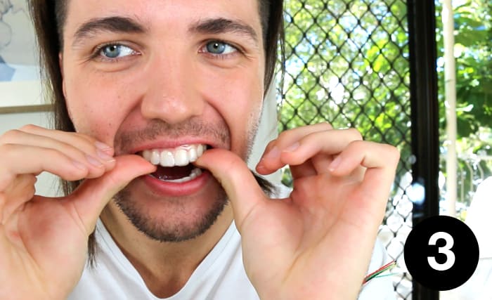 Placing Trays In Mouth